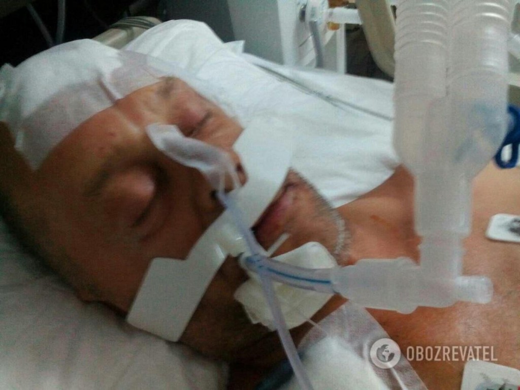В Турции умер избитый российским туристом запорожец: тело везут в Украину