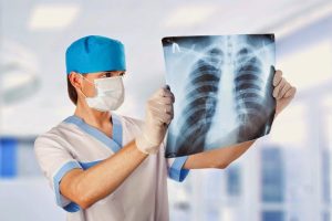 У Запорізькій області прогнозують спалах туберкульозу після війни: які є сценарії