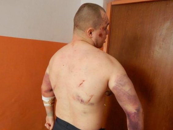Избиение под Rammstein и 5 лет за вскрытие вен: как поступают с неугодными в Бердянской колонии (ВИДЕО)