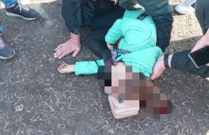 В “Дубовке” на девочку упала скульптура “медведь”: у ребенка ЧМТ и переломы (ВИДЕО)