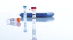 Антитела – не основание для отказа от COVID-прививки, – МОЗ