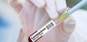 Результат за полчаса: МОЗ анонсировало новые бесплатные тесты на коронавирус