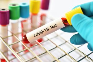 COVID-19 в Запорожской области: свежие цифры