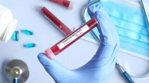 В Запорожской области нет новых случаев COVID-19: что по остальной Украине