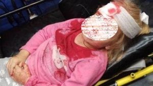 «Мама, на нас напали бандиты?»: 5-летняя девочка пострадала от рук силовиков в Беларуси (ФОТО, ВИДЕО)