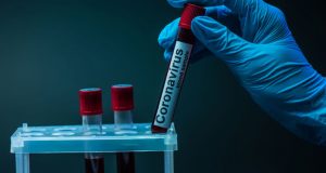 В Запорожской области второй день подряд рекорд заболеваемости COVID-19: данные по районам