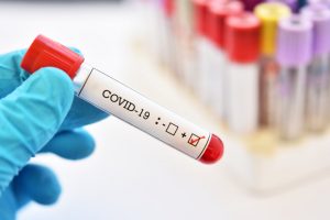 Почти по всей Запорожской области – новые случаи COVID-19: 4-й день подряд сообщается об умерших