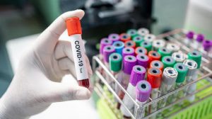 В Запорожской области 947 новых заболевших COVID-19: большую часть обнаружили в двух городах