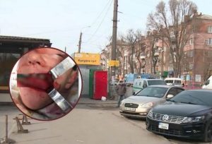 “Пришел домой, захлебываясь кровью”: в Днепре подростки жестоко избили 11-летнего мальчика (ФОТО)