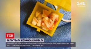 Стоматологи без согласия матери удалили ребенку сразу 12 зубов: подробности скандала под Киевом