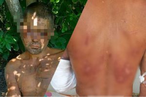 Братья-садисты едва не запытали до смерти мужчину под Запорожьем: эксклюзивные подробности (ФОТО)