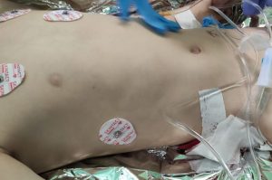 Через збройну агресію РФ в Україні загинуло 117 дітей