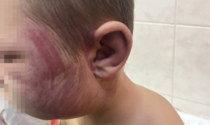 Під Запоріжжям чоловіка судитимуть за катування 8-річного сина (ФОТО)