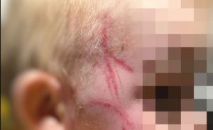 У Запоріжжі мати побила однорічного сина шнуром за його капризи (ФОТО)