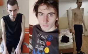 “Перетворився на скелет”: хлопець у Мелітополі тричі потрапляв у полон окупантів (ФОТО)