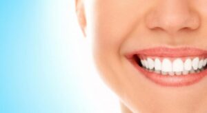Як покращити посмішку?