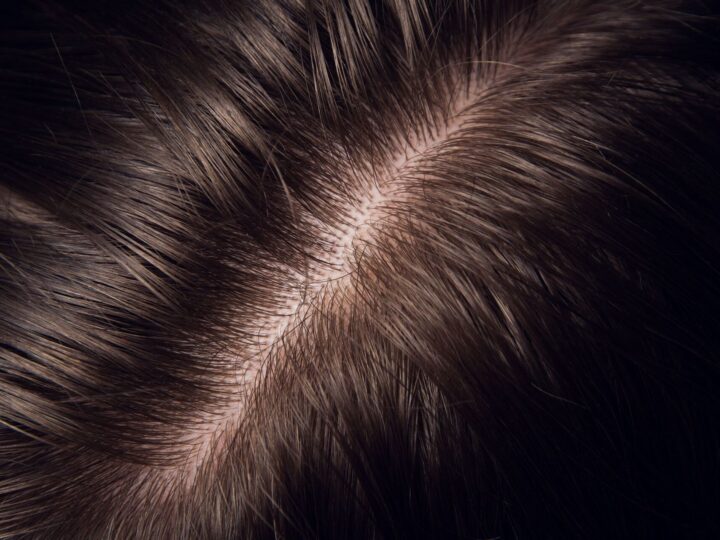 Регулярна детоксикація шкіри голови дає гарний результат