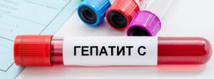 Хронічний вірусний гепатит C: перебіг, лікування та контроль стану